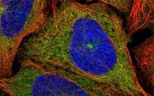 Prestige antibodies® HPA金标抗体,免疫染色金标准 Prestige antibodies® HPA金标抗体,免疫染色金标准