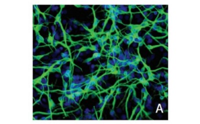 scm005 Microscopic image shows a complex network of fluorescent green cells against a dark background.