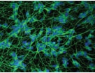 fluor-detection-Hoechst-HCS.png fluor-detection-Hoechst-HCS.png
