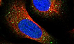 prestige antibodies