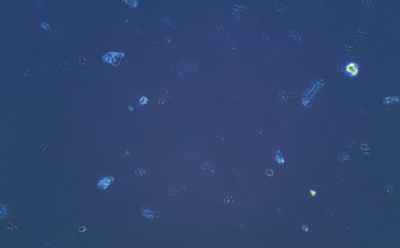 Cell culture precipitates Cell culture precipitates