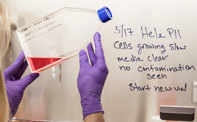 Poor cell growth Poor cell growth