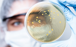 <p>在下游处理过程中控制生物负载的策略</p> A laboratory technician is holding a petri dish containing a growth medium with several small yellow colonies visible on its surface. The technician is wearing blue latex gloves, and the background shows a blurred laboratory setting.