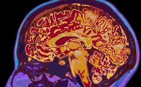 Neuroscience Research Neuroscience Research