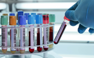 Blood samples fill a test tube rack Researcher placing blood samples for clinical diagnostics into a test tube rack.