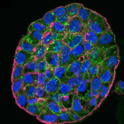 ZRB 1599 Scientist looking at cells in a flask
