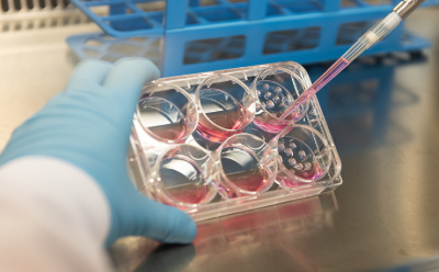 IBD co-culture screen Scientist holds a plate up to remove media from a 6 well plate during organoid culture.