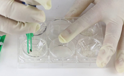 PDO screen Scientist uses tweezers in one well of a 6 well plate during a PDO monolayer culture.