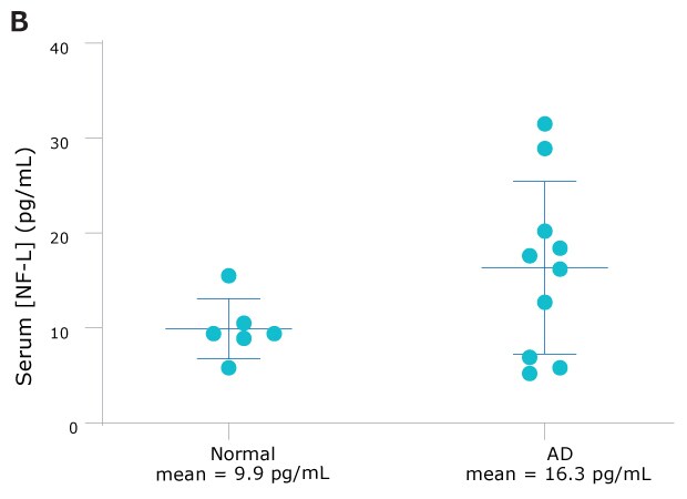 NF-L Serum Figure 如图所示,AD(n=10)样本中的NF-L浓度将近正常(n=6)样本的两倍。