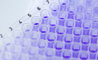 Metabolite Libraries A clear plastic 96-well microplate used for laboratory experiments, with visible numbering along the side from 2 to 7.