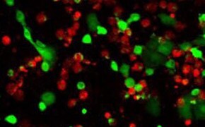 Live/dead cell double staining Cell Health Analysis