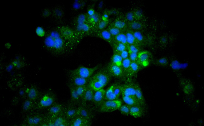 在 HL-1 筛选的 FBS 存在下，核周 ANF（绿色）和核 DAPI（蓝色）的荧光网染色