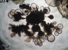 Lung organoids cultured with the 3dGRO™ Human Lung Organoid Culture System 使用 3dGRO™ 人肺器官培养系统培养的源自 iPSC 的人肺器官组织