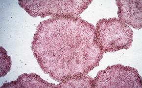 H9 human ES cells stained with alkaline phosphatase (AP) H9 human ES cells stained with alkaline phosphatase (AP)