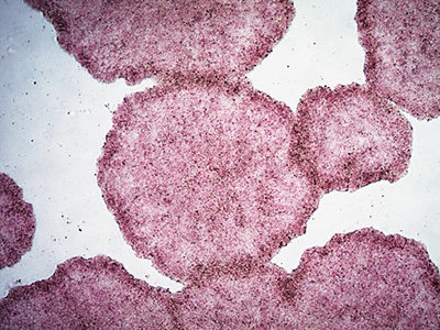 H9 human ES cells stained with alkaline phosphatase (AP) 图像显示的似乎是一组形状不规则的紫粉色圆球,背景则是一片苍白。