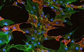 Mesenchymal stem cells Mesenchymal stem cells