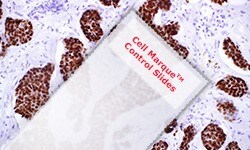 Cell Marque™ control slides for IHC staining Cell Marque™对照玻片的IHC染色显微图像