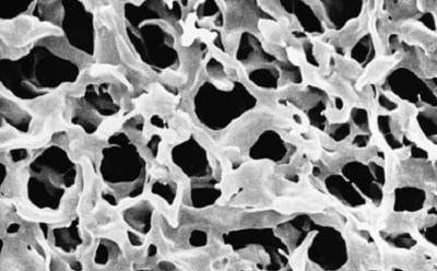 PVDF membrane filter 聚偏二氟乙烯(PVDF)膜滤器的扫描电子显微镜图像