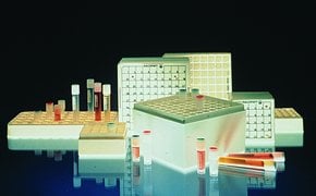Lipids and fatty acids standards for testing industries.