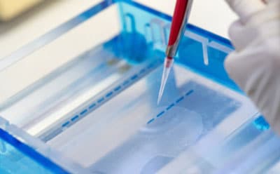 Agarose gel electrophoresis A close-up image of a laboratory setting, showing a person’s hand in a white glove holding a pipette and dispensing a blue liquid into a container filled with clear liquid. The container is placed within another larger transparent container, possibly for stability or containment purposes. The background is out of focus, emphasizing the action of pipetting.