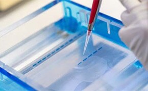 一只戴着手套的手在蓝色凝胶电泳室上方拿着移液管，准备将液体样本注入里面的透明凝胶中。