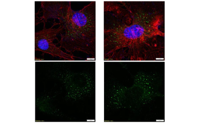 Immunocytochemistry analysis Anti-FLT4 Antibody 共有四张免疫细胞化学图片。左上角的图片中有两个被椭圆形轮廓包围的细胞,中间的椭圆形代表细胞核。细胞内分布着许多小点。右上角的图片中,有一个代表细胞的矩形,其中一个椭圆形代表细胞核。细胞内分布着许多小点。下方的图片中也有小点,这些小点与上方图片中的小点相对应。