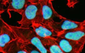 ZooMAb<sup>®</sup> immunofluorescnce 这些细胞呈矩形,覆盖了整个图像,矩形中央的椭圆形代表细胞核。