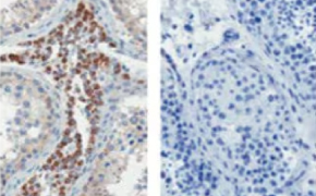 ZooMAb<sup>®</sup> immunohistochemistry 包埋的人类睾丸组织切片的免疫组化染色。每张图像中都有椭圆形标记,代表不同颜色的细胞。