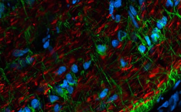 Secondary Antibodies 大鼠视神经冷冻切片,小鼠抗神经丝蛋白 H 和 CF568 山羊抗小鼠染色(神经元过程,红色),兔抗 GFAP 和 CF488A 山羊抗兔染色,高度交叉吸附(神经胶质细胞,绿色)。细胞核用 RedDot2(青色)染色。