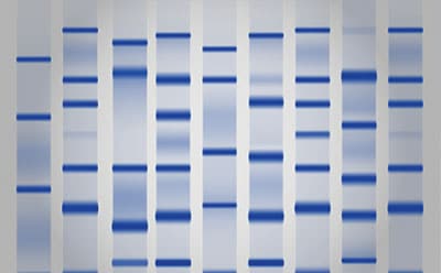 An image of a gel stain, showing protein bands. There are nine vertical columns that all have at least three horizontal bands representing the proteins. 