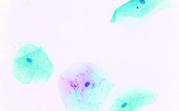 Cytology Stains