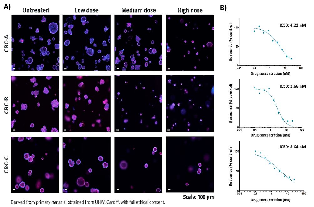 Drug screening using 3dGRO™ Human CRC Organoids Confocal microscopy images of human CRC organoids in a drug screening experiment.