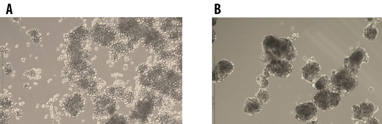 Tumorsphere formation of E006AA Prostate Cancer Cells at Passage Tumorsphere formation of E006AA Prostate Cancer Cells at Passage