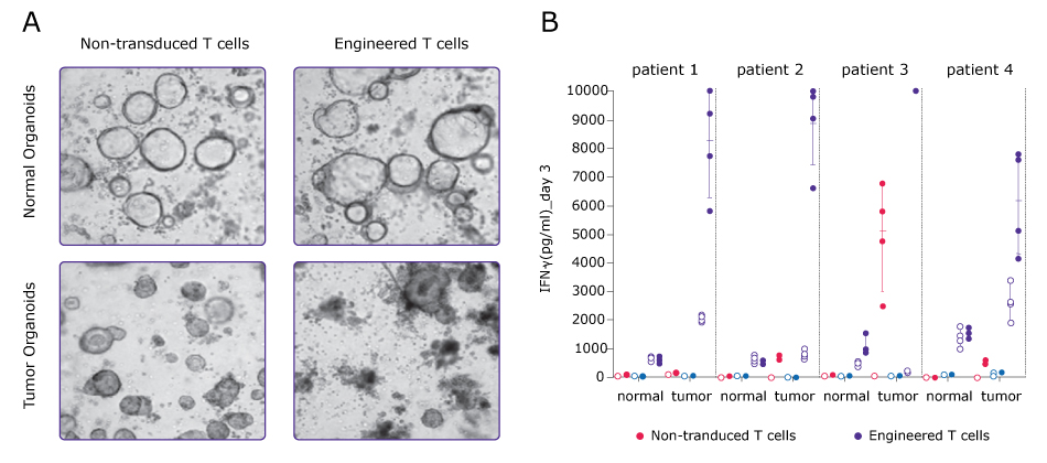 Evaluate tumor organoid killing and T cell activation: cytokine analysis Left, microscopy images of PDO and engineered T cell co-cultures. Right, IFNу activity in PDO cultures in the presence of non-transduced T cells or engineered T cells; the activity is only seen in tumor PDOS with engineered T cells.