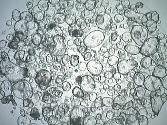 Human colon organoids Human colon organoids