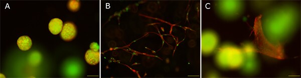 Mono- and co-culture of MCF-7 cells and fibroblasts in TrueGel3D™ hydrogels Mono- and co-culture of MCF-7 cells and fibroblasts in TrueGel3D™ hydrogels