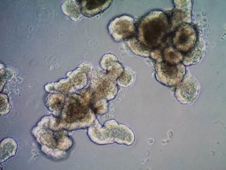 Mouse intestinal organoid. Mouse intestinal organoid.