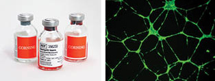 Corning Human Umbilical Vein Endothelial Cells (HUVEC-2) stained with Calcein AM and cultured on Corning Matrigel matrix.