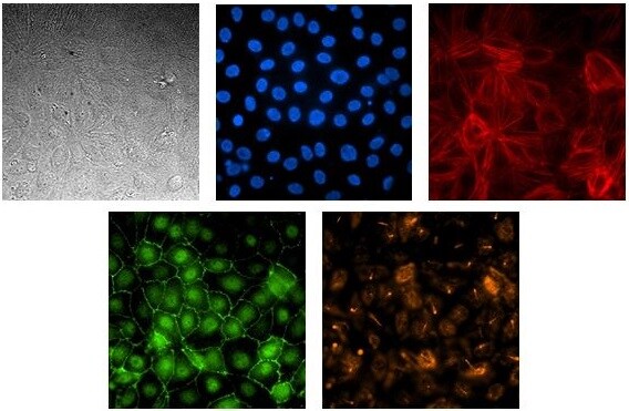 Create a 3D kidney nephrotoxicity model on the AIM Biotech 3D cell culture chip Renal proximal tubule epithelial cell line SA7K form a polarized, tight barrier on the AIM Biotech chip.