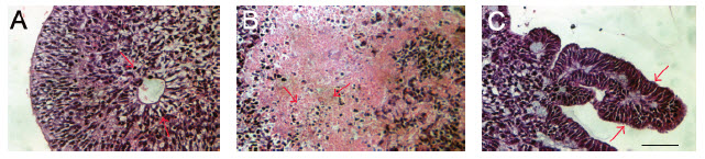 Sections of EBs stained with hematoxylin and eosin illustrating differentiation into ectoderm Sections of EBs stained with hematoxylin and eosin illustrating differentiation into ectoderm