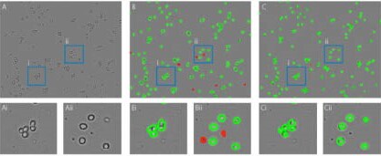 Improvement of the artificial intelligence algorithm of the Corning Cell Counter. A) unprocessed image. B) Results of the old algorithm, many cells in clusters are not detected properly and debris is wrongly detected as dead cells. C) Results of the new algorithm, all individual cells within clusters are detected properly and no debris is detected as dead cells. Ai-Cii) Zoomed in images of blue boxes containing examples of the improved individual cell detection (i) and dead cell detection (ii).