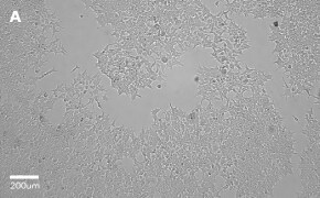 Brightfield imaging of HEK 293T cells on Millicell<sup>®</sup> DCI Digital Cell Imager at 10X magnification