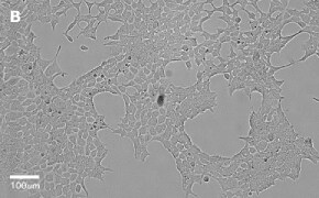Brightfield imaging of HEK 293T cells on Millicell<sup>®</sup> DCI Digital Cell Imager at 20X magnification
