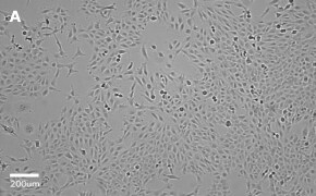 Brightfield imaging of MRC-5 Sv2 cells on Millicell<sup>®</sup> DCI Digital Cell Imager at 10X magnification