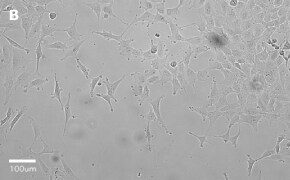 Brightfield imaging of MRC-5 SV2 cells on Millicell<sup>®</sup> DCI Digital Cell Imager at 20X magnification