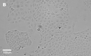 Brightfield imaging of T24T cells on Millicell<sup>®</sup> DCI Digital Cell Imager at 20X magnification