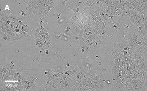 Brightfield imaging of A431 cells on Millicell<sup>®</sup> DCI Digital Cell Imager at 10X magnification