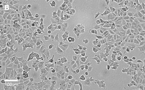 Brightfield imaging of MCF-7 cells on Millicell<sup>®</sup> DCI Digital Cell Imager at 20X magnification