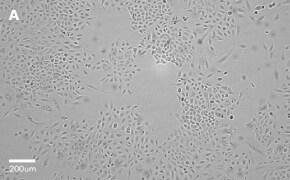 Brightfield imaging of A549 cells on Millicell<sup>®</sup> DCI Digital Cell Imager at 10X magnification
