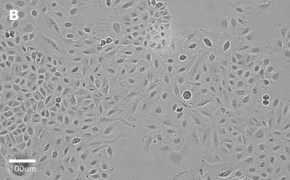 Brightfield imaging of A459 cells on Millicell<sup>®</sup> DCI Digital Cell Imager at 20X magnification